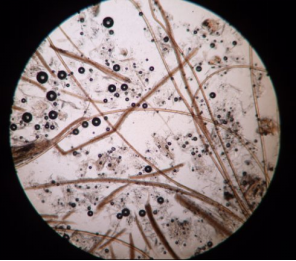 反复头油难"断根",快用酮康唑洗剂