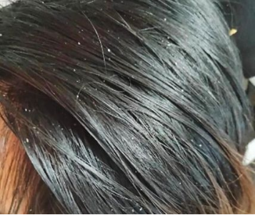 春雨医生 春雨医生