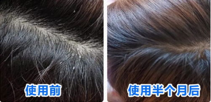 春雨医生 春雨医生