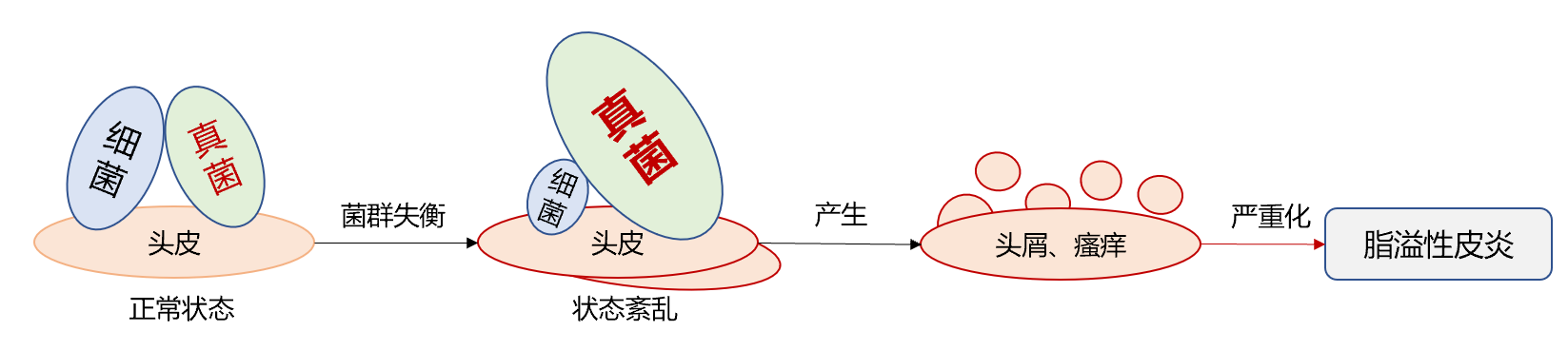 菌群平衡:头皮微生物群通常由细菌和真菌组成,一般包括葡萄球菌,丙酸
