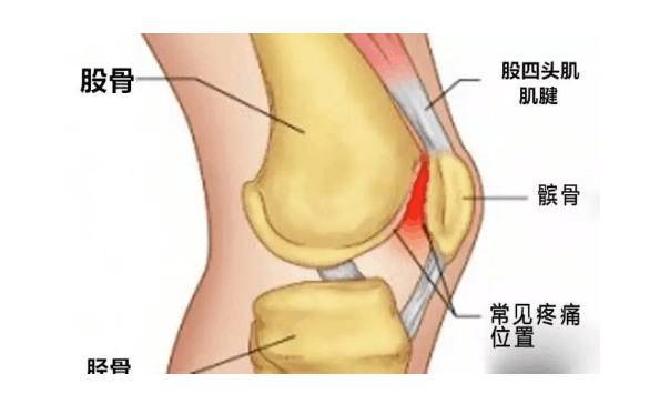 膝盖肌腱在哪个位置图片