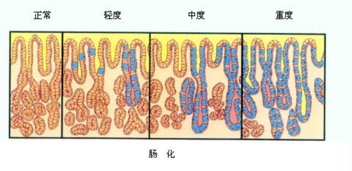 胃粘膜分层图解图片