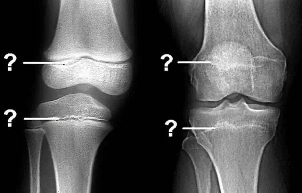 春雨医生 春雨医生