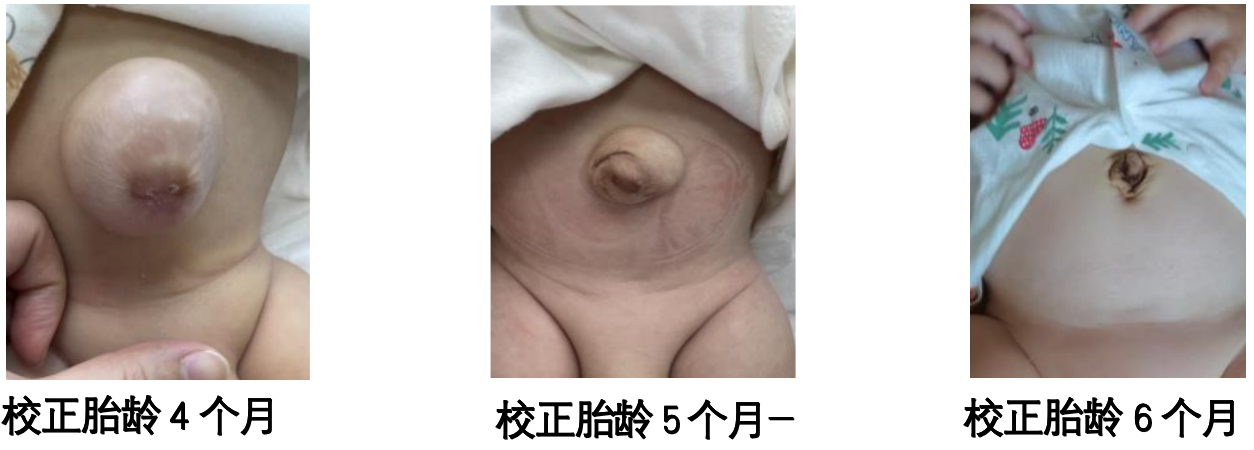 春雨医生