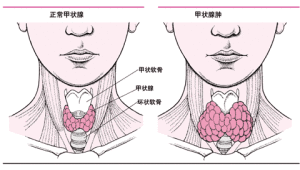 春雨医生