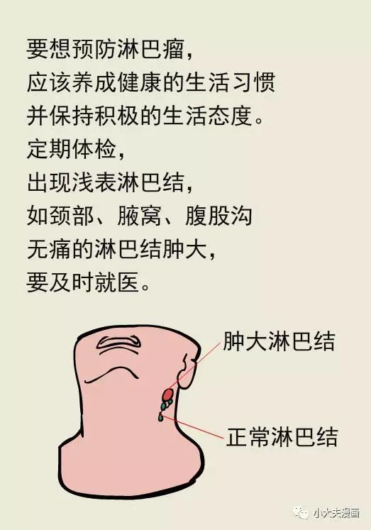 淋巴结是什么引起的图片