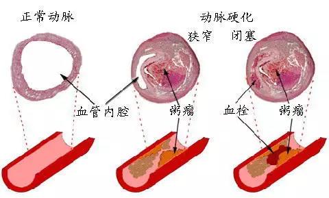 春雨医生